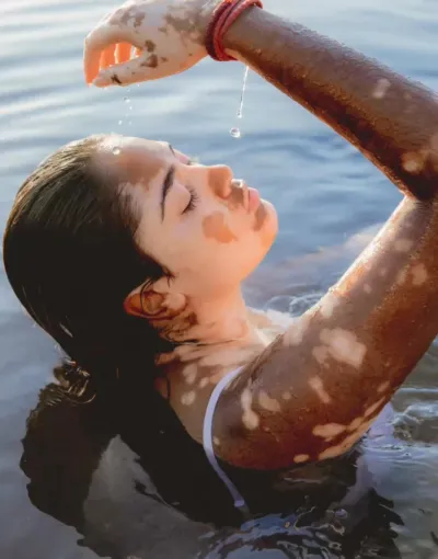 Les soins après l'été pour une peau sublime, Veauche, Kyroma Institut