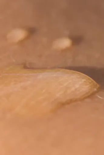 L'épilation définitive au laser : est-ce douloureux ?, Veauche, Kyroma Institut