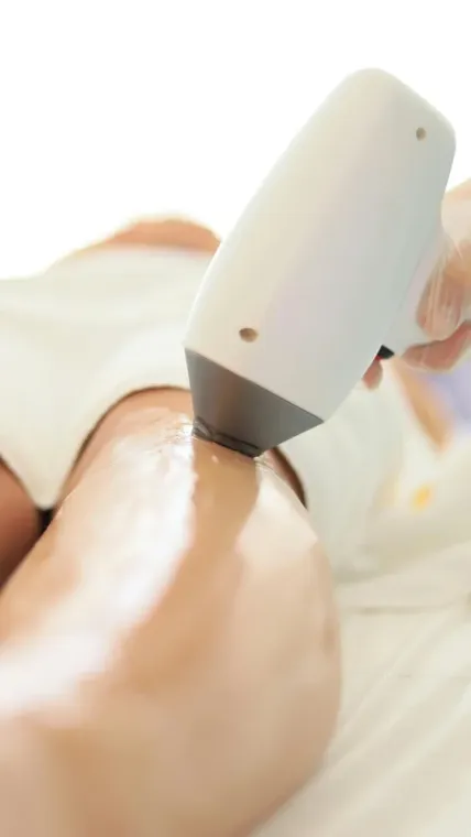 Est-ce que le laser va sur moi ?, Veauche, Kyroma Institut