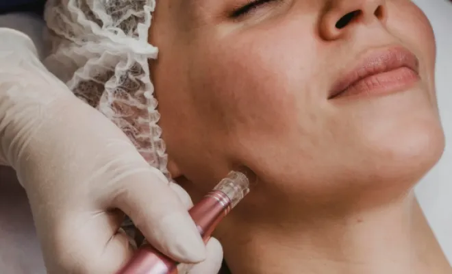 Microstimulation, Veauche, Kyroma Institut